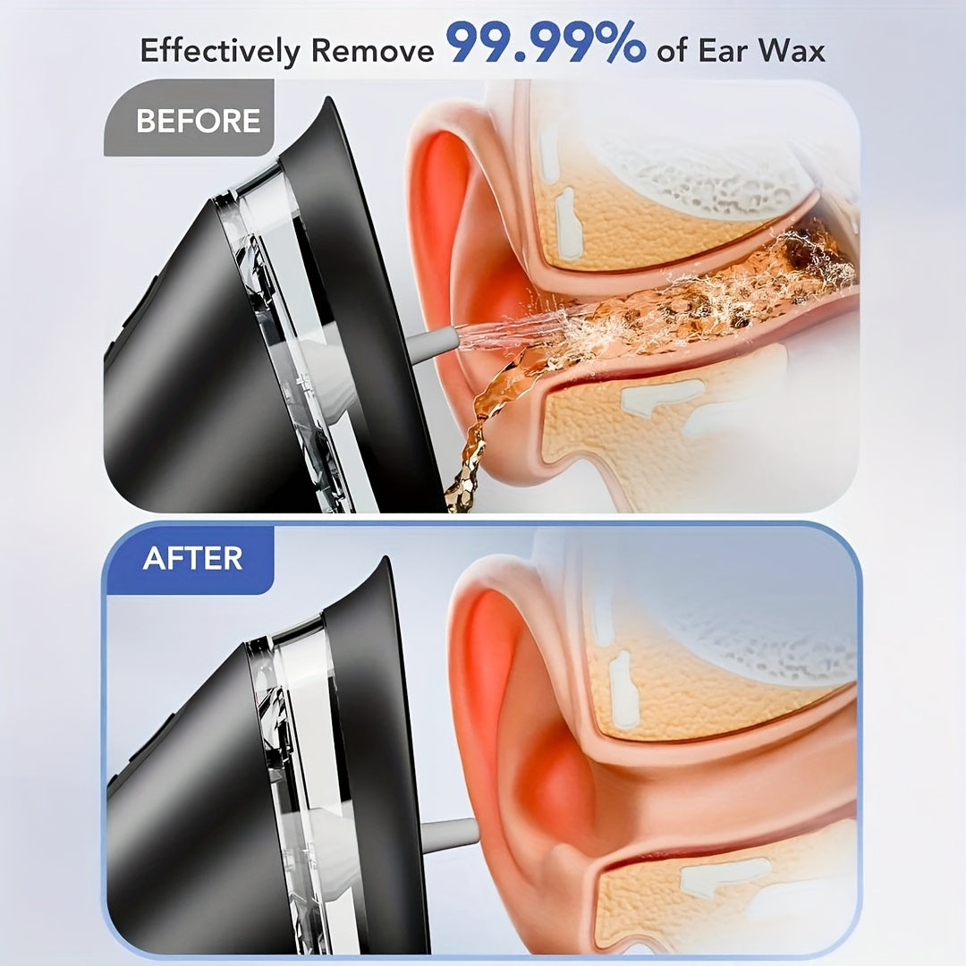 Extracteur électrique de cérumen, nettoyeur rechargeable par USB et système d'eau