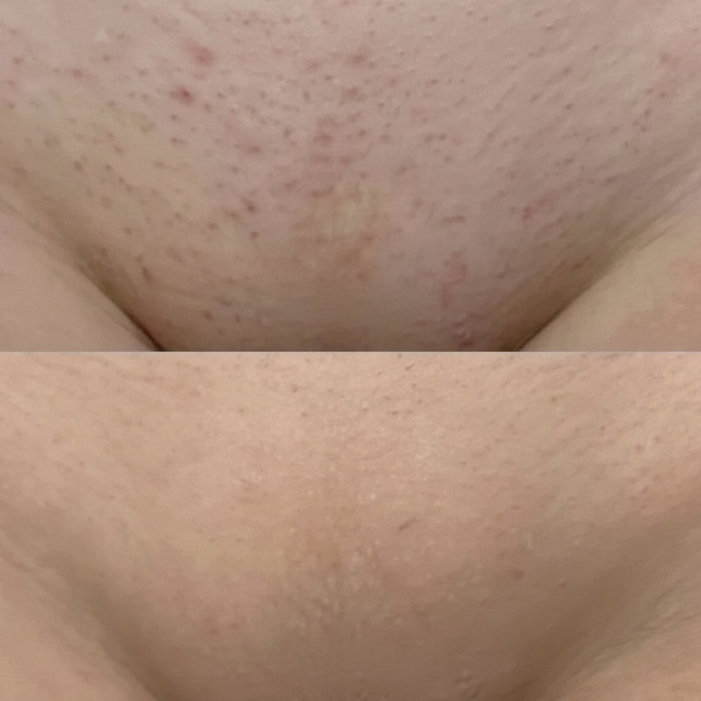 Rasoir électrique pour femmes, étanche, pour peau sensible et pour la ligne du bikini