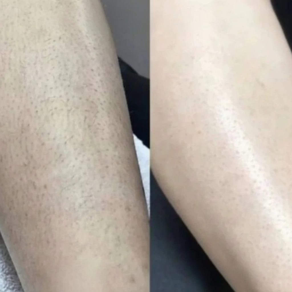 Rasoir électrique pour femmes, étanche, pour peau sensible et pour la ligne du bikini