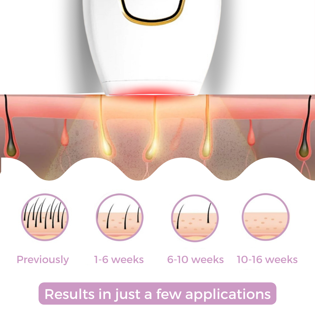Appareil d'épilation IPL I Épilation laser de référence à domicile