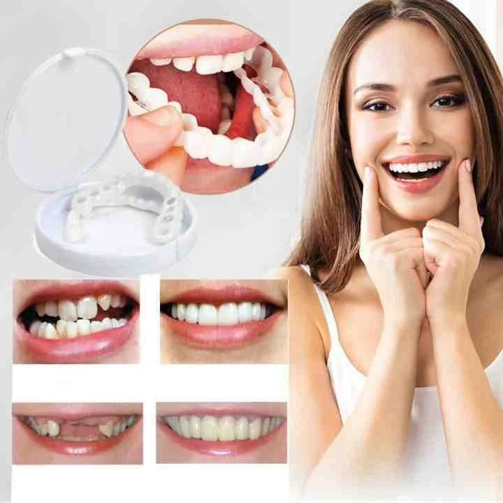 Prothèse dentaire à clipser | Design qui s'appuie sur les dents, sans adhésif | Pour un sourire radieux sans visite chez